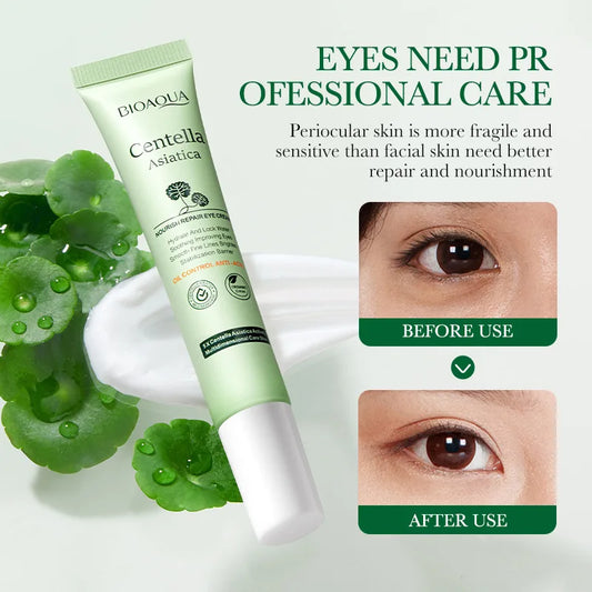 Centella Asiatica Eye Cream – Anti-Dark Circles, Puffiness & Wrinkle Repair | Hydrating & Anti-Aging Eye Care