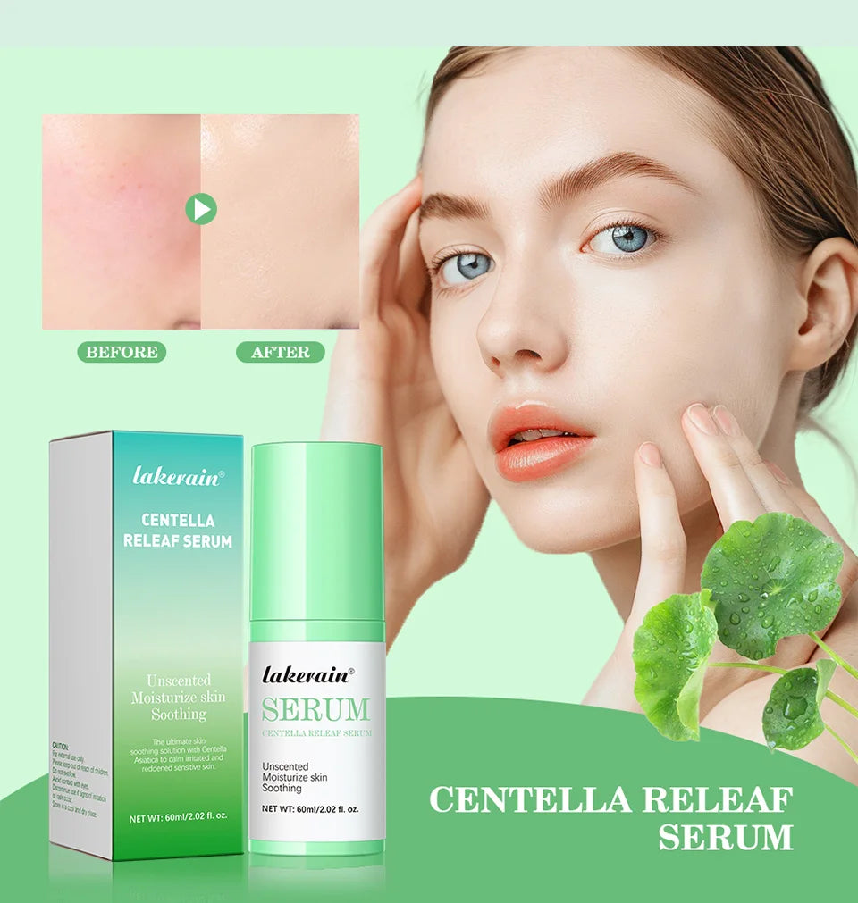 Centella Asiatica Facial Serum – Soothing, Hydrating & Repairing Gel Essence | Korean Skin Care for Radiant, Calm Skin
