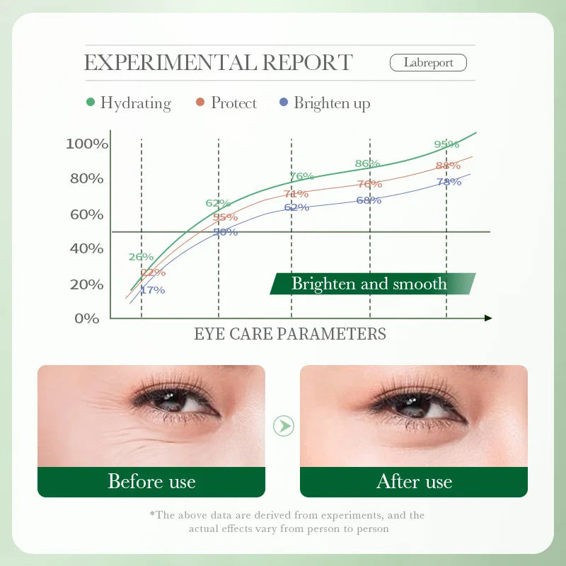 Centella Asiatica Eye Cream – Anti-Dark Circles, Puffiness & Wrinkle Repair | Hydrating & Anti-Aging Eye Care