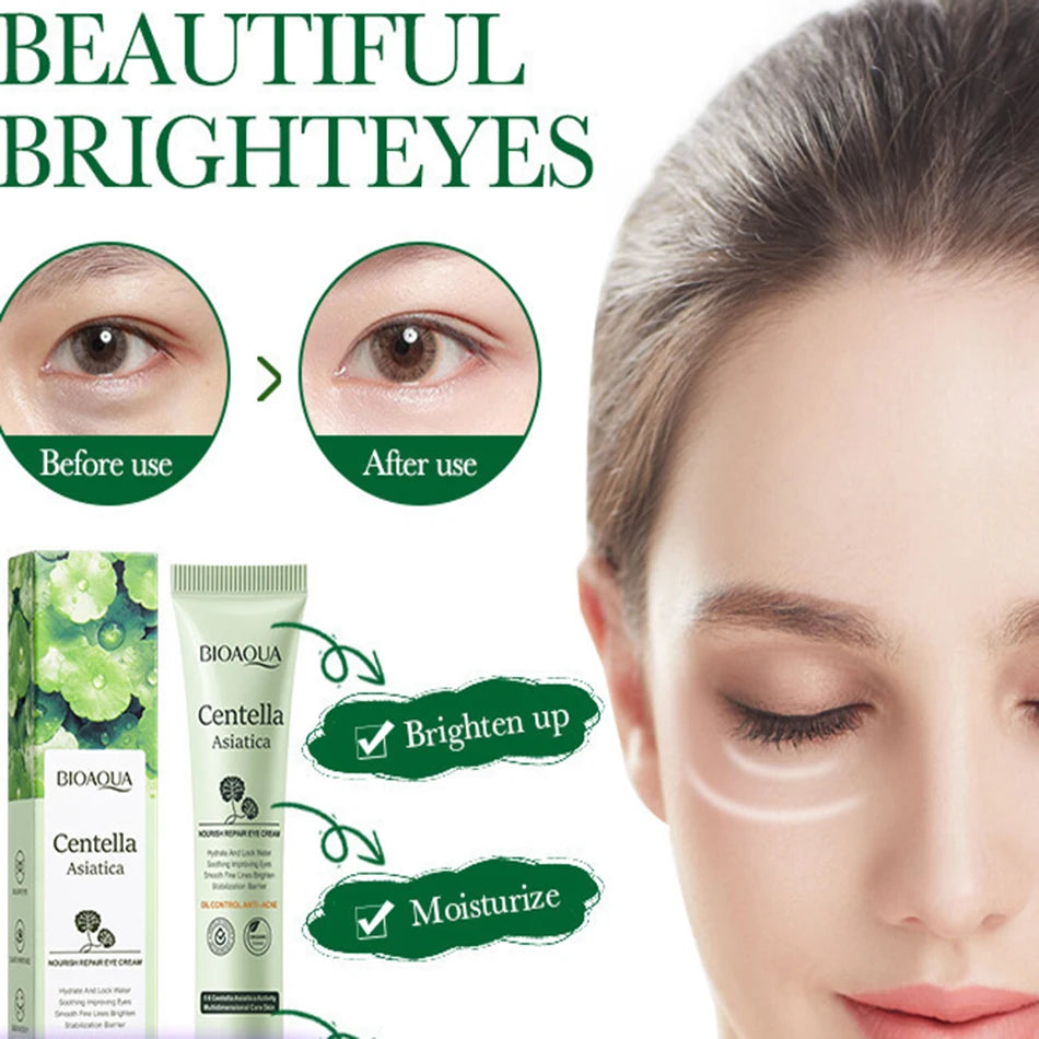 Centella Asiatica Eye Cream – Anti-Dark Circles, Puffiness & Wrinkle Repair | Hydrating & Anti-Aging Eye Care