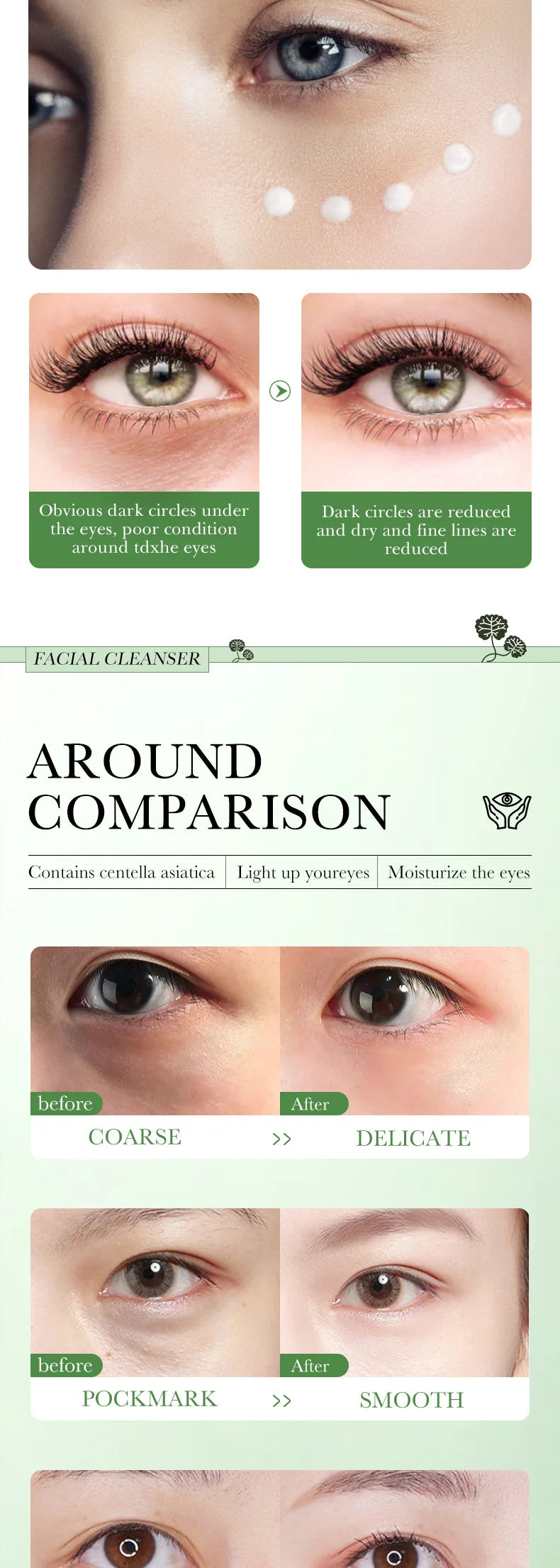 Centella Asiatica Eye Cream – Anti-Dark Circles, Puffiness & Wrinkle Repair | Hydrating & Anti-Aging Eye Care