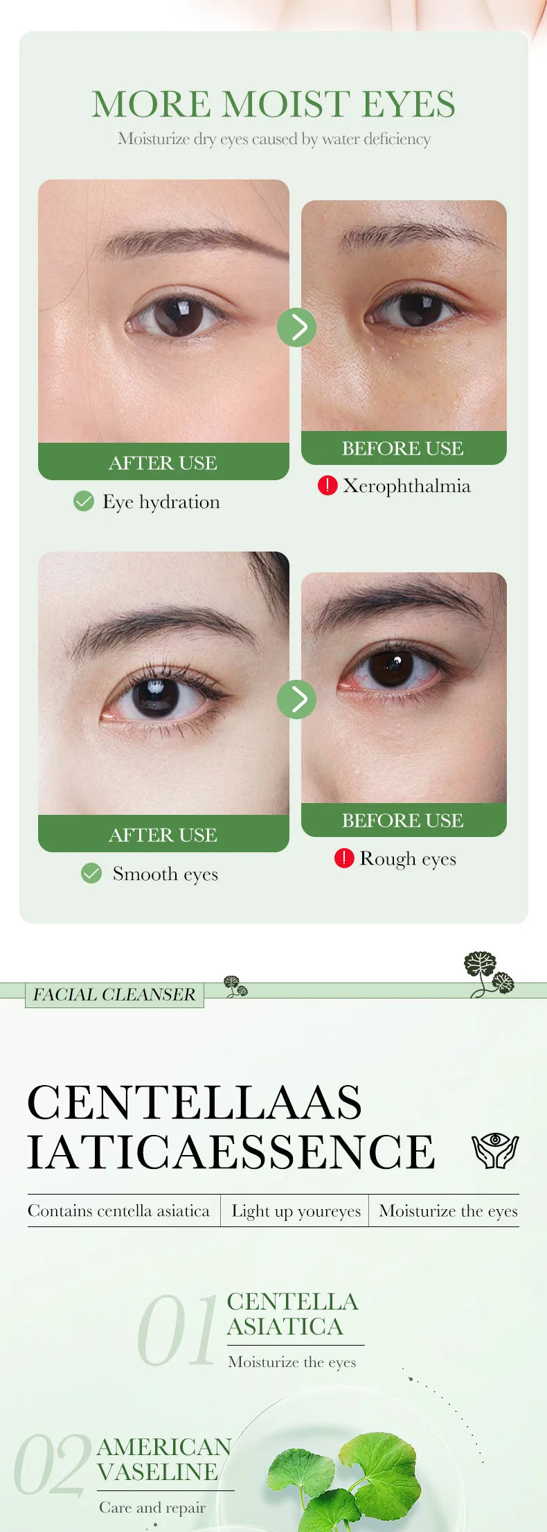 Centella Asiatica Eye Cream – Anti-Dark Circles, Puffiness & Wrinkle Repair | Hydrating & Anti-Aging Eye Care