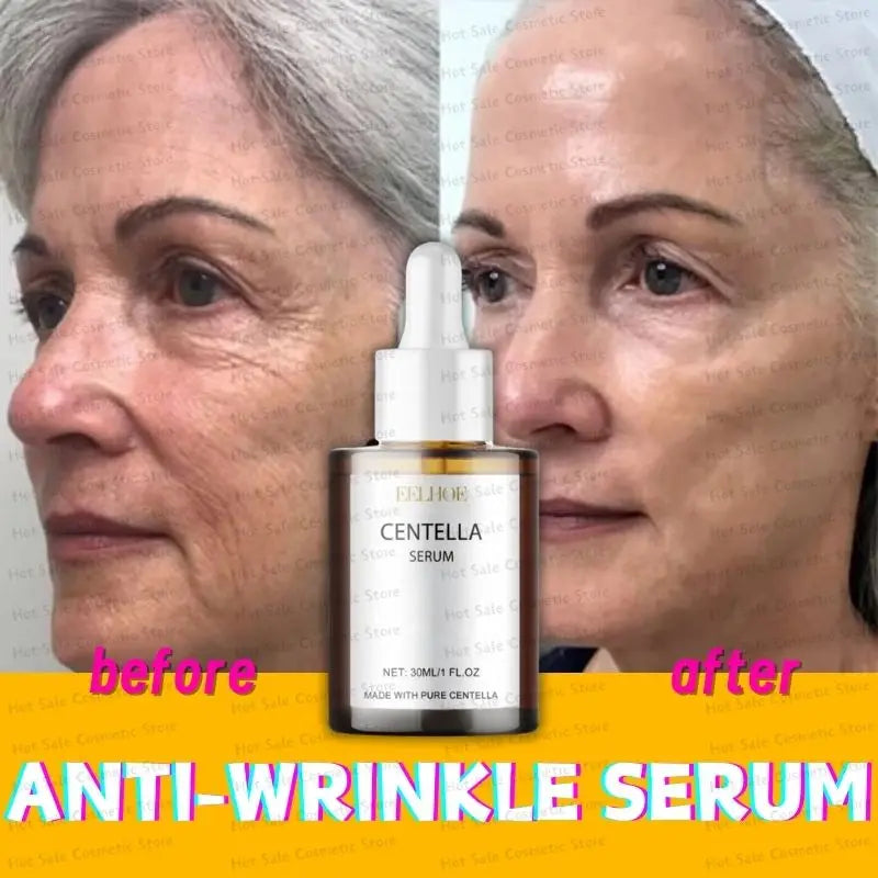 Korean Centella Asiatica Face Serum – Nourish Dry Skin, Smooth, Rejuvenate, Brighten & Whitening Facial Moisturizer