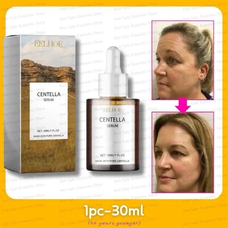 Korean Centella Asiatica Face Serum – Nourish Dry Skin, Smooth, Rejuvenate, Brighten & Whitening Facial Moisturizer