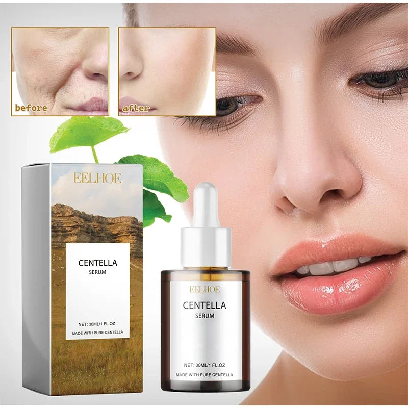 Korean Centella Asiatica Face Serum – Nourish Dry Skin, Smooth, Rejuvenate, Brighten & Whitening Facial Moisturizer